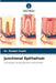 Junctional Epithelium by Roopal Gupta