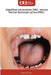 StepWise excavation (SW) versus Partial Removal caries (PRC) by Samir Fellahi