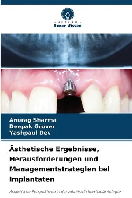 Ästhetische Ergebnisse, Herausforderungen und Managementstrategien bei Implantaten by Anurag Sharma, Deepak Grover, Yashpaul Dev