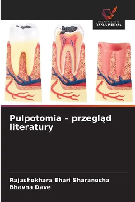 Pulpotomia - przegląd literatury by Rajashekhara Bhari Sharanesha, Bhavna Dave