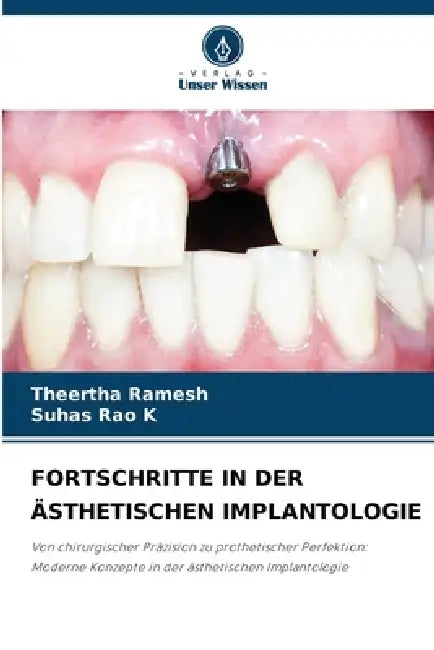 Fortschritte in Der Ästhetischen Implantologie by Theertha Ramesh, Suhas Rao K.