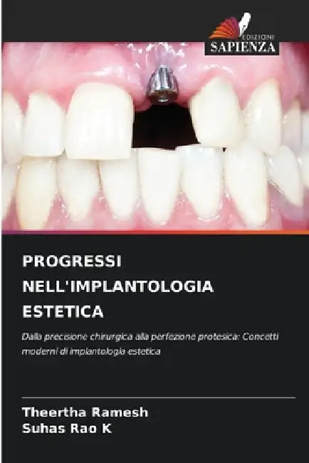 Progressi Nell'implantologia Estetica by Theertha Ramesh, Suhas Rao K.