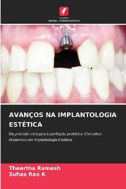Avanços Na Implantologia Estética by Theertha Ramesh, Suhas Rao K.