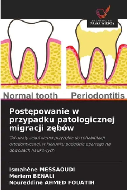 Postępowanie w przypadku patologicznej migracji zębów by Ismahène Messaoudi, Meriem Benali, Noureddine Ahmed Fouatih