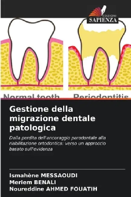 Gestione della migrazione dentale patologica by Ismahène Messaoudi, Meriem Benali, Noureddine Ahmed Fouatih