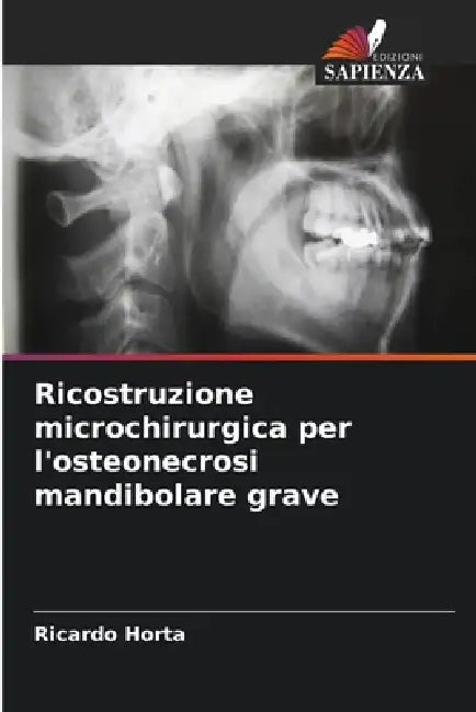 Ricostruzione microchirurgica per l'osteonecrosi mandibolare grave by Ricardo Horta