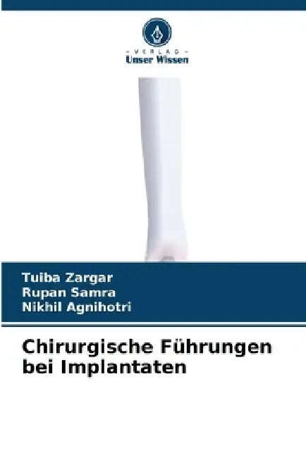 Chirurgische Führungen bei Implantaten by Tuiba Zargar, Rupan Samra, Nikhil Agnihotri