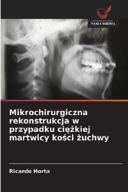 Mikrochirurgiczna rekonstrukcja w przypadku ciężkiej martwicy kości żuchwy by Ricardo Horta