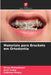 Materiais para Brackets em Ortodontia by Divya Maheshwari, Arun Urala, Subraya Mogra