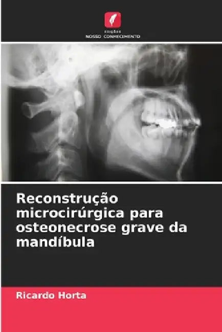 Reconstrução microcirúrgica para osteonecrose grave da mandíbula by Ricardo Horta