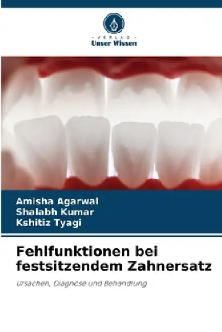 Fehlfunktionen bei festsitzendem Zahnersatz by Amisha Agarwal, Shalabh Kumar, Kshitiz Tyagi