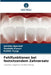 Fehlfunktionen bei festsitzendem Zahnersatz by Amisha Agarwal, Shalabh Kumar, Kshitiz Tyagi