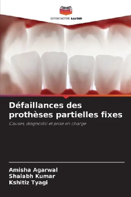 Défaillances des prothèses partielles fixes by Amisha Agarwal, Shalabh Kumar, Kshitiz Tyagi