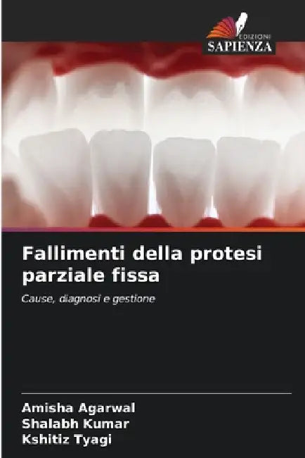 Fallimenti della protesi parziale fissa by Amisha Agarwal, Shalabh Kumar, Kshitiz Tyagi