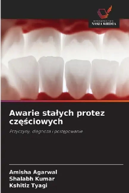 Awarie stalych protez częściowych by Amisha Agarwal, Shalabh Kumar, Kshitiz Tyagi