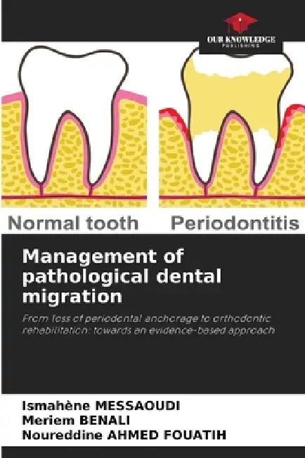 Management of pathological dental migration by Ismahène Messaoudi, Meriem Benali, Noureddine Ahmed Fouatih