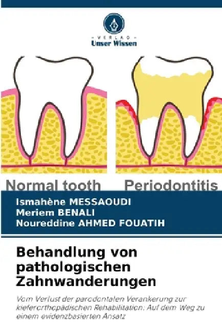 Behandlung von pathologischen Zahnwanderungen by Ismahène Messaoudi, Meriem Benali, Noureddine Ahmed Fouatih