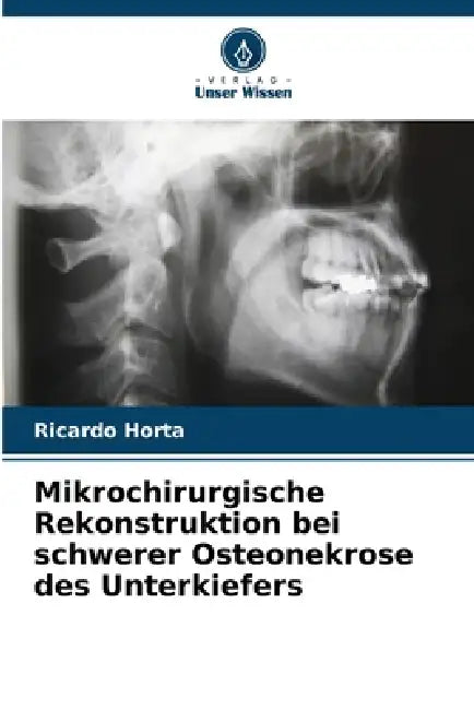 Mikrochirurgische Rekonstruktion bei schwerer Osteonekrose des Unterkiefers by Ricardo Horta