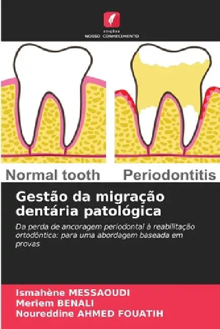 Gestão da migração dentária patológica by Ismahène Messaoudi, Meriem Benali, Noureddine Ahmed Fouatih