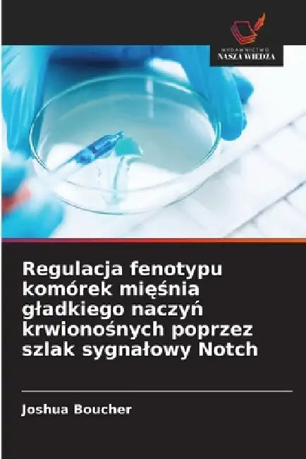 Regulacja fenotypu komórek mięśnia gladkiego naczyń krwionośnych poprzez szlak sygnalowy Notch by Joshua Boucher