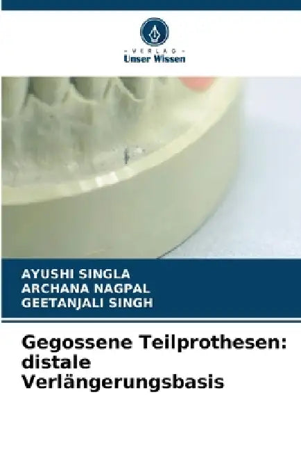 Gegossene Teilprothesen: distale Verlängerungsbasis by Ayushi Singla, Archana Nagpal, Geetanjali Singh