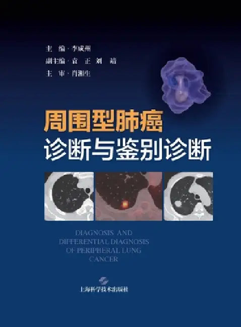 Diagnosis and Differential Diagnosis of Peripheral Lung Cancer/周围型肺癌诊断与鉴别诊 by 李成州 主编
