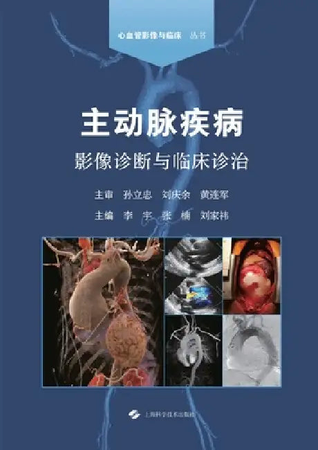 Imaging Diagnosis and Clinical Management of Aortic Diseases/主动脉疾病影像诊断与临& by 李宇 张楠 ࠵