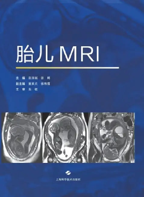 Fetal MRI/胎儿MRI by 张国福 张鹤