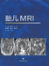 Fetal MRI/胎儿MRI by 张国福 张鹤