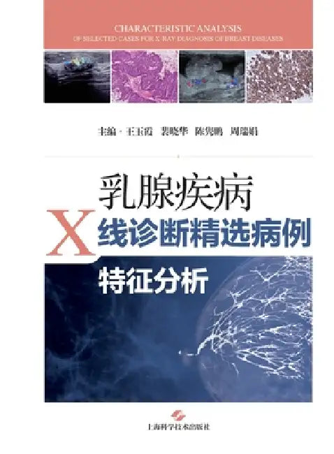 Selected Case Feature Analysis of Mammographic Diagnosis of Breast Diseases/乳腺疾病X线诊断精选& by 王玉霞 裴晓