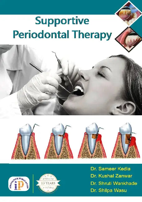 Supportive Periodontal Therapy by Dr. Sameer Kedia