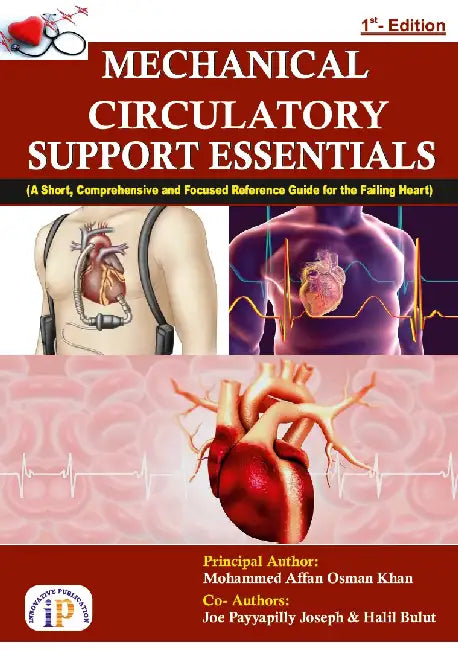 Mechanical Circulatory Support Essentials by Mohammed Affan Osman Khan