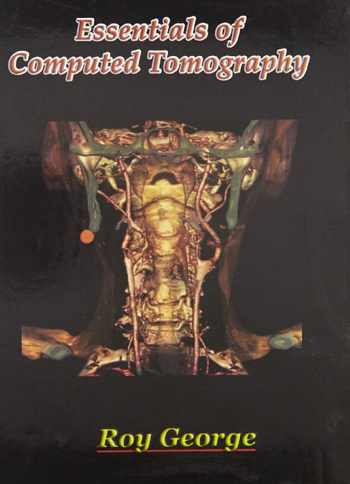 Essentials of Computed Tomography by Roy George