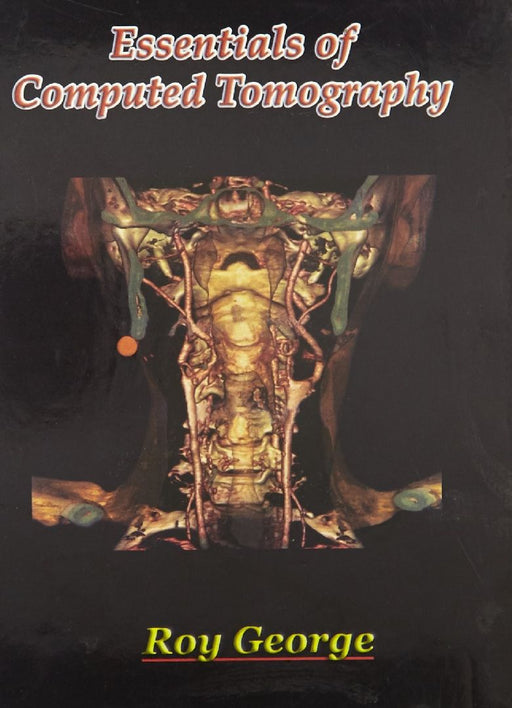 Essentials of Computed Tomography by Roy George