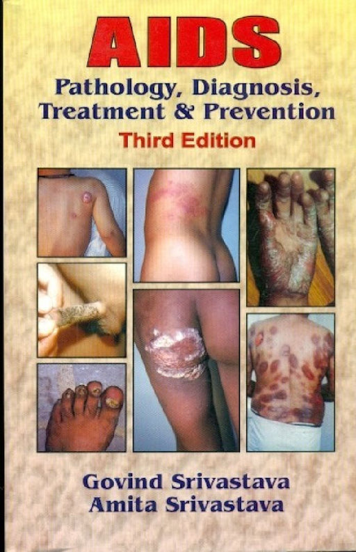 AIDS: Pathology, Diagnosis, Treatment & Prevention, 3e by Srivastava/Srivastava