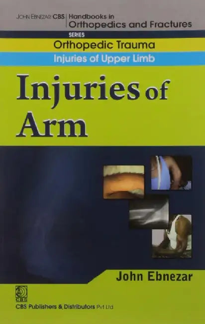 John Ebnezar CBS Handbooks in Orthopedics and Fractures: Orthopedic Trauma: Injuries of Upper Limb : Injuries of Arm by Ebnezar John