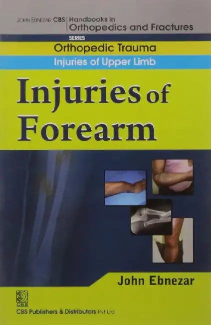 John Ebnezar CBS Handbooks in Orthopedics and Fractures: Orthopedic Trauma: Injuries of Upper Limb :Injuries of Forearm by Ebnezar John