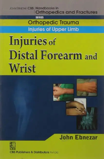 John Ebnezar CBS Handbooks in Orthopedics and Fractures: Orthopedic Trauma: Injuries of Upper Limb :Injuries of distal forearm and wrist by Ebnezar John
