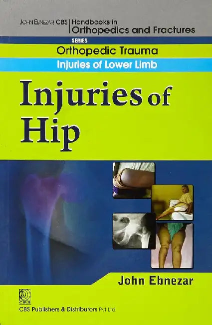 John Ebnezar CBS Handbooks in Orthopedics and Fractures: Orthopedic Trauma: Injuries of Lower Limb :Injuries of Hip by Ebnezar John