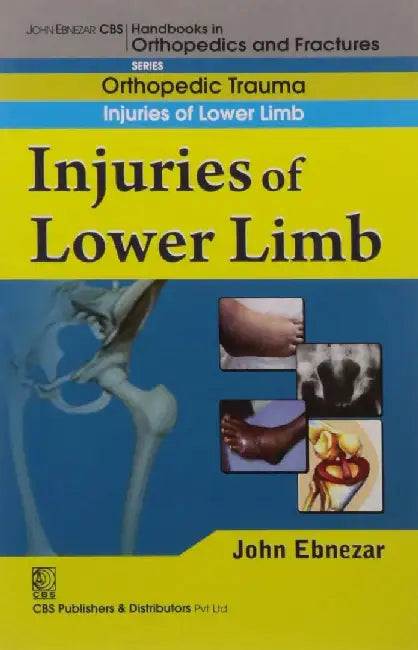 John Ebnezar CBS Handbooks in Orthopedics and Fractures: Orthopedic Trauma: Injuries of Lower Limb by Ebnezar John