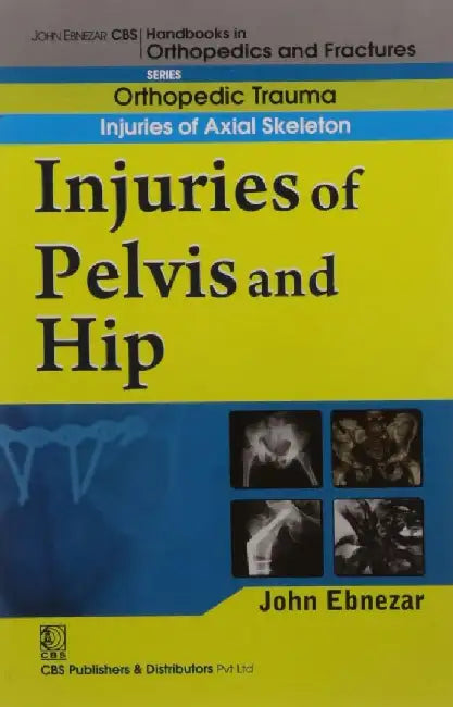 John Ebnezar CBS Handbooks in Orthopedics and Fractures: Orthopedic Trauma: Injuries of Axial Skeleton :Injuries of Pelvis and Hip by Ebnezar John