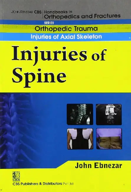 John Ebnezar CBS Handbooks in Orthopedics and Fractures: Orthopedic Trauma: Injuries of Axial Skeleton :Injuries of Spine by Ebnezar John