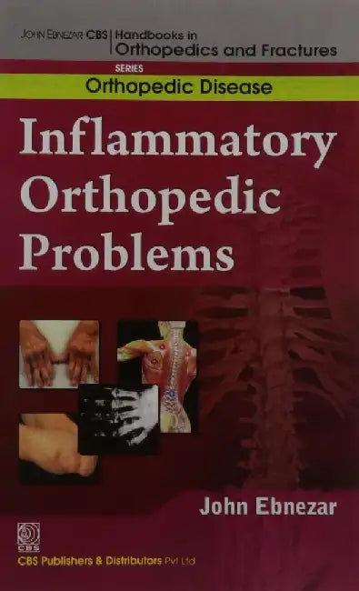 John Ebnezar CBS Handbooks in Orthopedics and Fractures: Orthopedic Disease :Inflammatory Orthopedic Problems by Ebnezar John