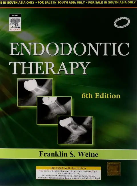 Endodontic Therapy, 6e by Weine