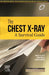 The Chest X-Ray: A Survival Guide by De Lacey