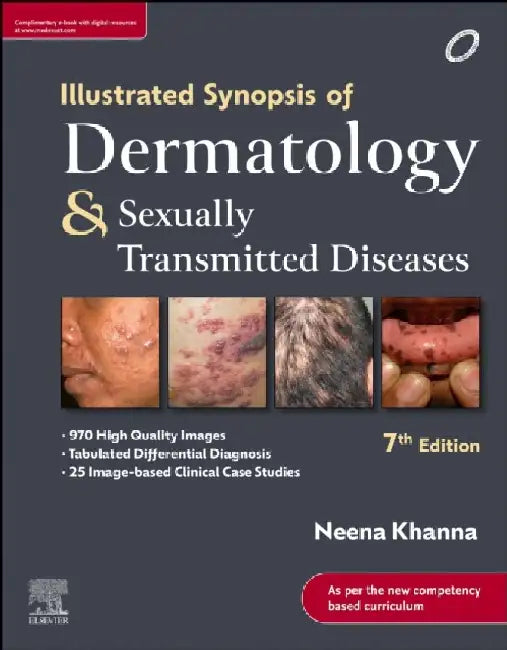 Illustrated Synopsis Of Dermatology And Sexually Transmitted Diseases, 7e With Access Code by Khanna N.