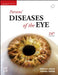 Parsons Diseases Of The Eye, 24e With Access Code by Sihota R.