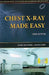 Chest X Ray Made Easy 5e by Corne J