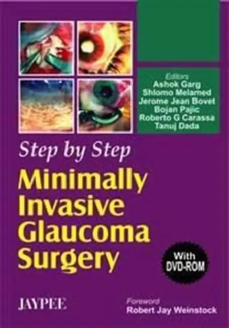Step By Step Minimally Invasive Glaucoma Surgery With Dvd-Rom by Ashok Garg