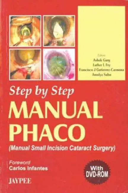 Step By Step Manual Phaco With Dvd-Rom by Ashok Garg